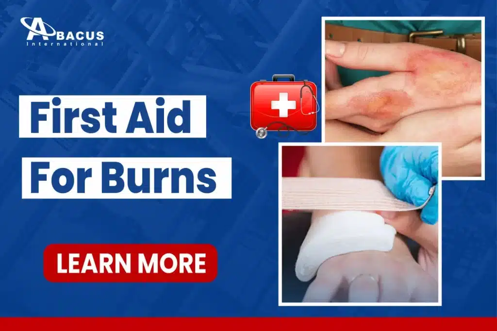 Burns First Aid Guide