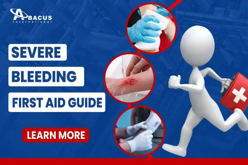 Severe Bleeding First Aid Guide